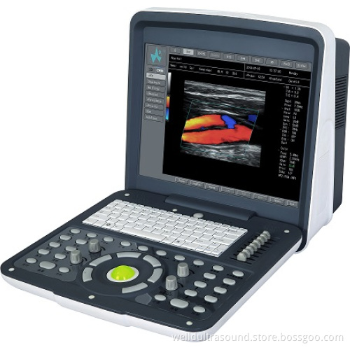 FULL DIGITAL COLOR DOPPLER DIAGNOSTICL SYSTEM